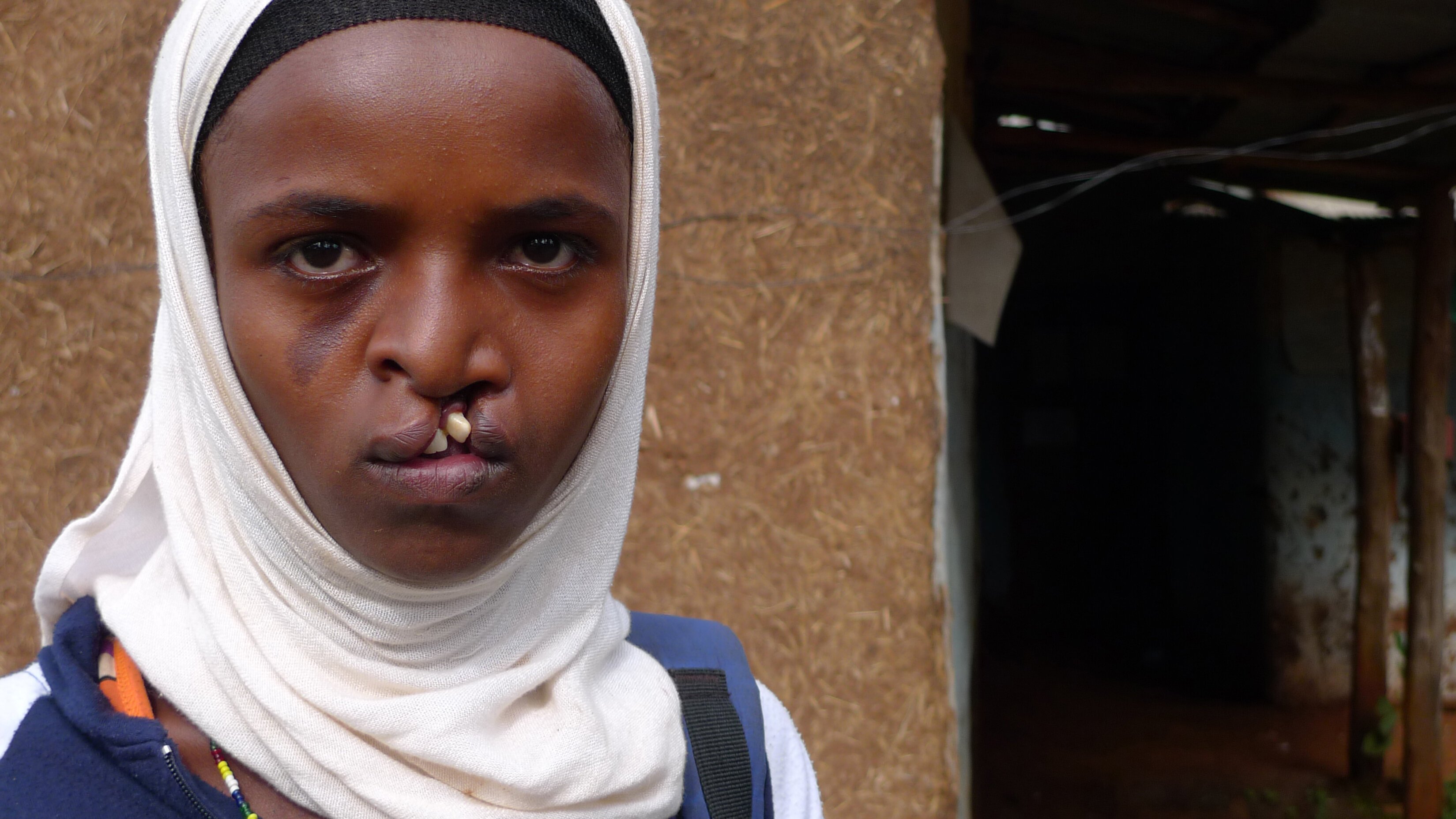 Drömmar om ett leende