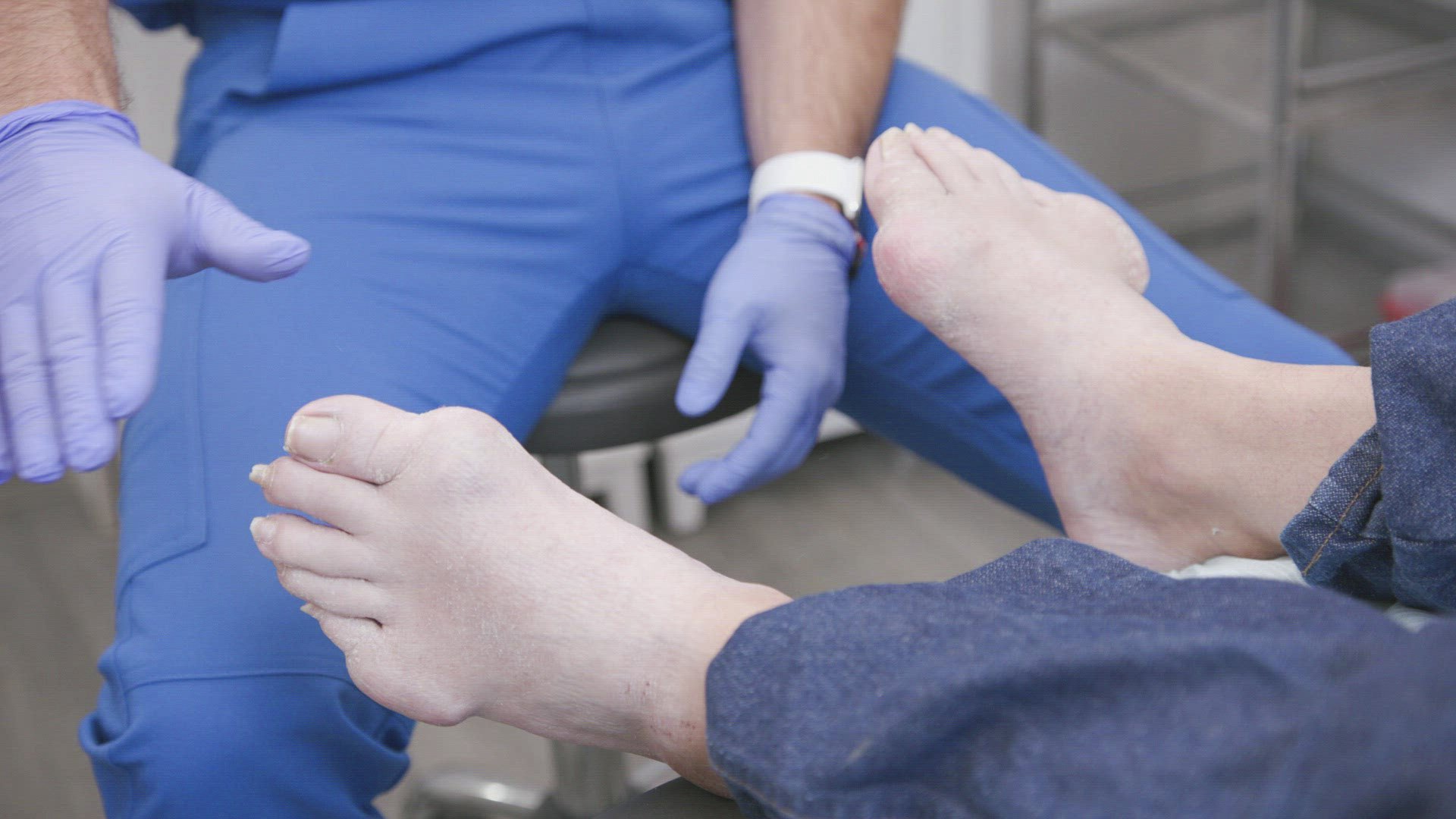 2. Hammerhead Foot