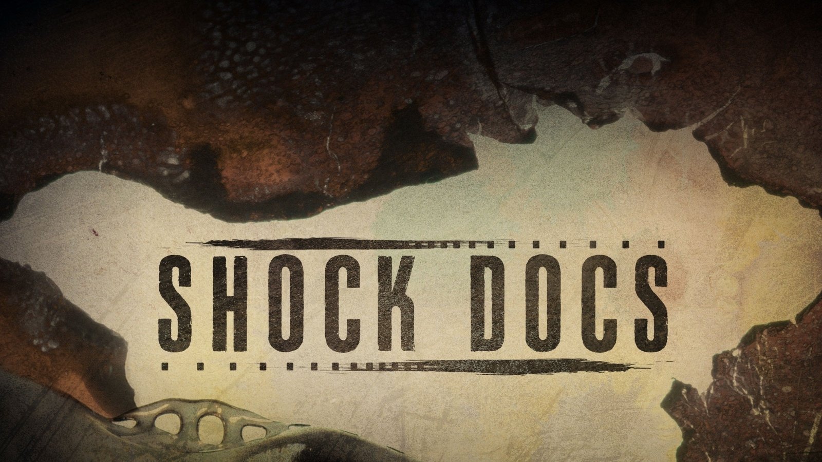 Shock Docs