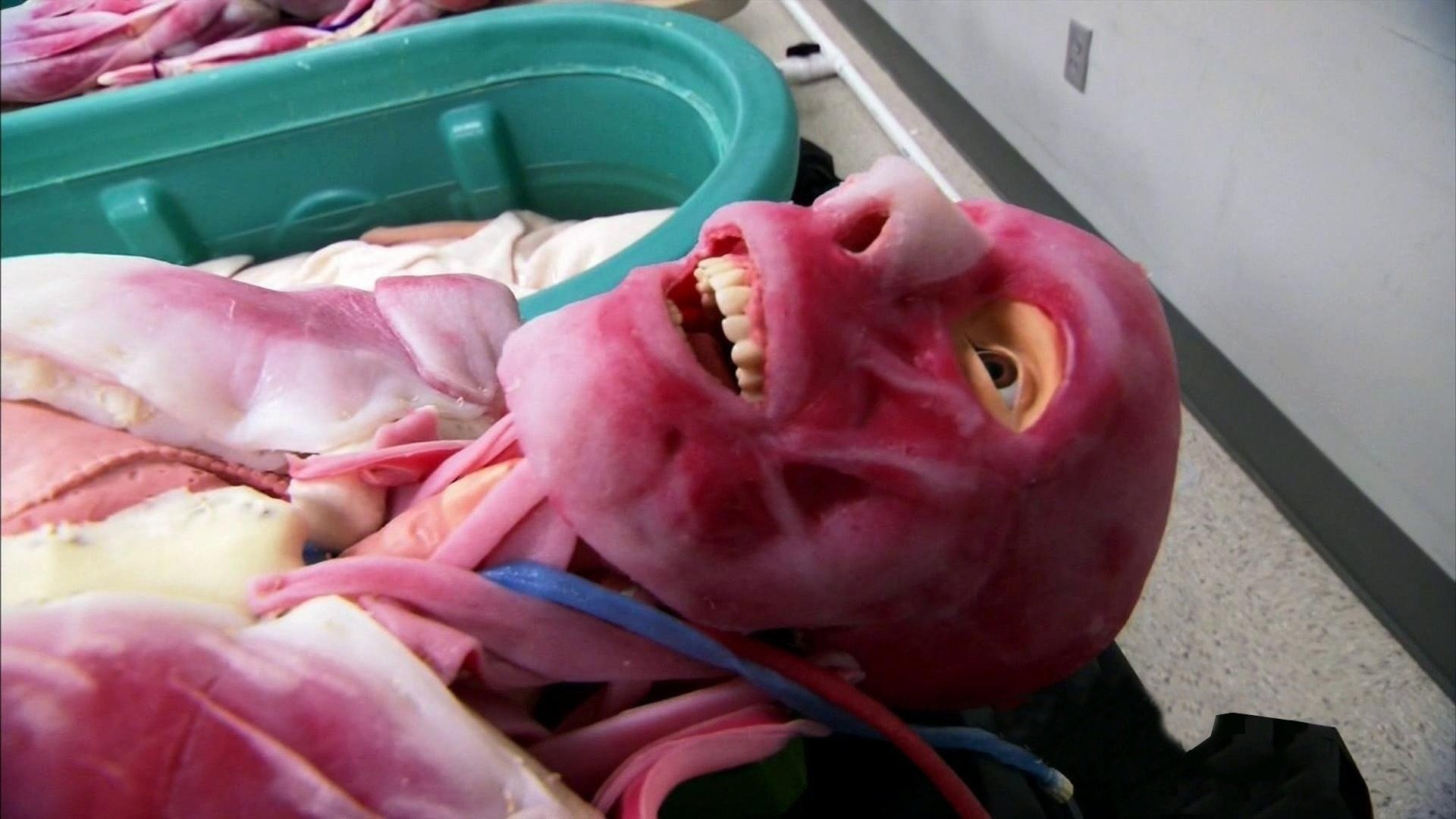 11. Do No Bodily Harm