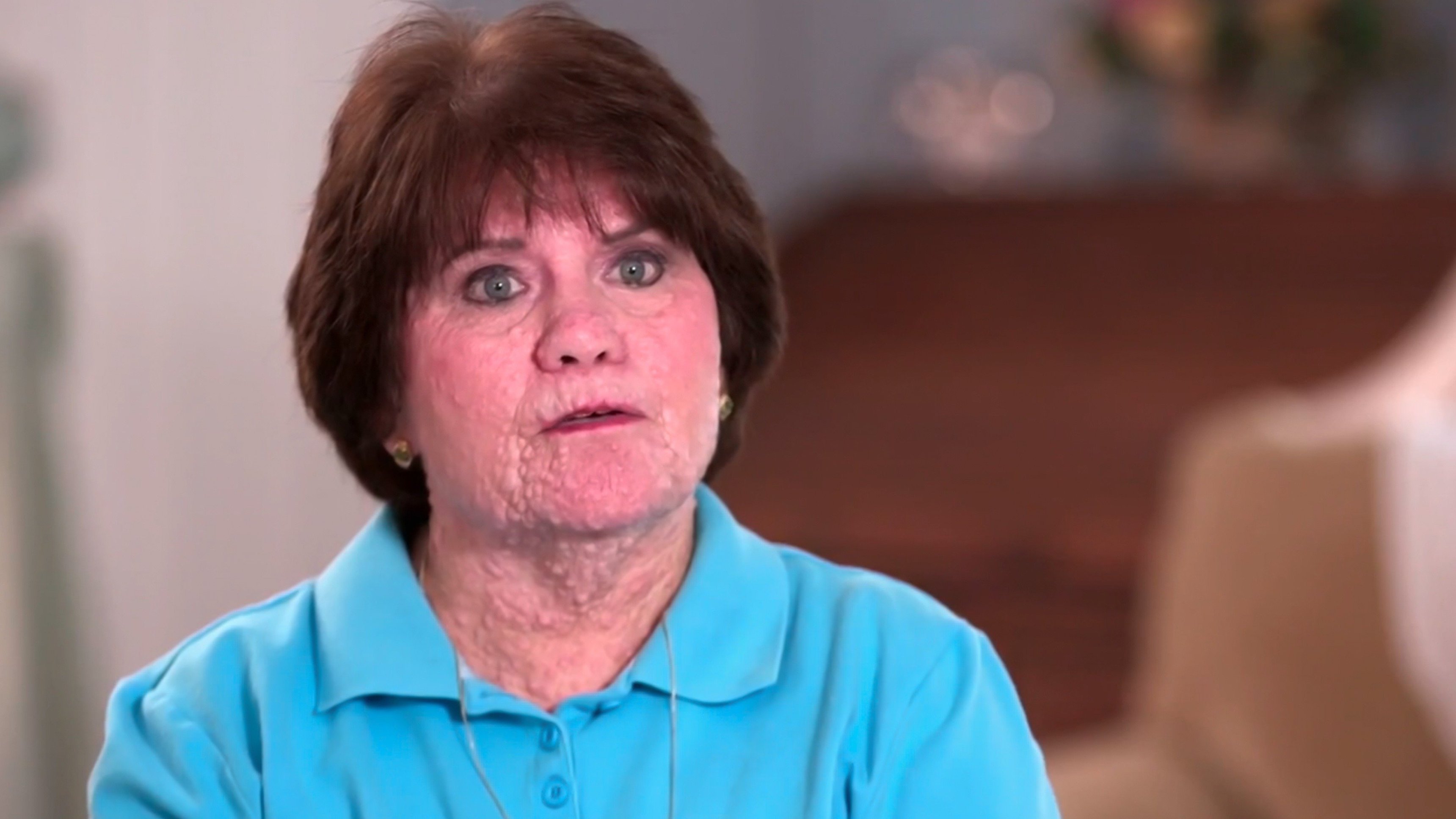 4. The Curious Case Of The Pooting Cyst